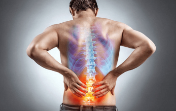Sciatica Treatment